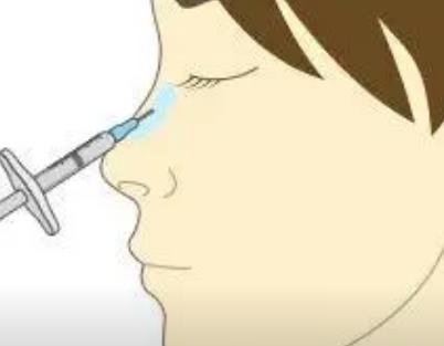 垫鼻梁的好方法有哪些?垫鼻梁可以维持多久?手术前后注意事项!