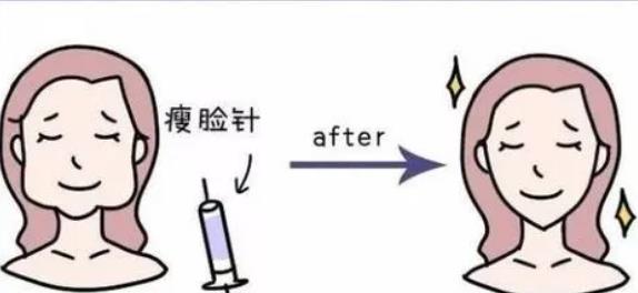 打注射瘦脸前后果图曝光|手术前后要注意哪些事情?果可以维持多久?