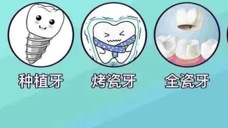 种牙多少钱一颗啊？种植牙的价格与哪些因素有关？