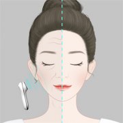 脸上红血丝如何消除？保养的方法有哪些？
