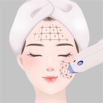 像素激光去痘印果怎么样?内含激光祛痘印的优点和注意事项!