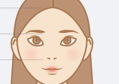 隆鼻后鼻孔内侧增生图怎么样?疤痕增生要怎么调节?