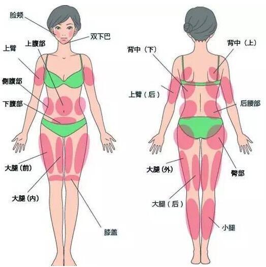 吸脂塑型果好吗？术后恢复情况吗~
