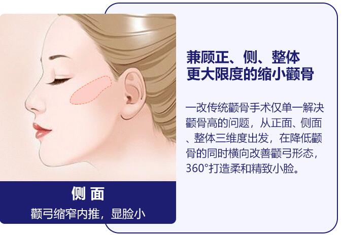 额头窄颧骨高怎么办？额头窄颧骨高的手术应该如何做？