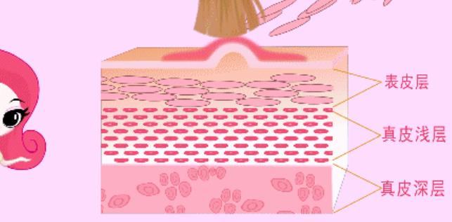 果酸换肤能去痘坑吗？做果酸在之后如何护理面部肌肤？