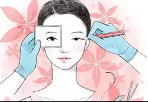 为什么割双眼皮后疤痕肉条?设计过宽、术中出xue、眼轮匝肌肥厚都有可能