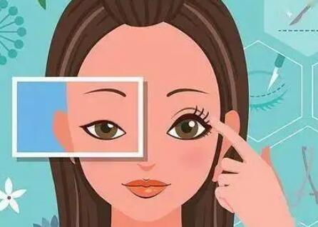为什么割双眼皮后疤痕肉条?设计过宽、术中出xue、眼轮匝肌肥厚都有可能