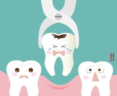 拔牙后的注意事项有哪些？拔牙以后几天能恢复正常？