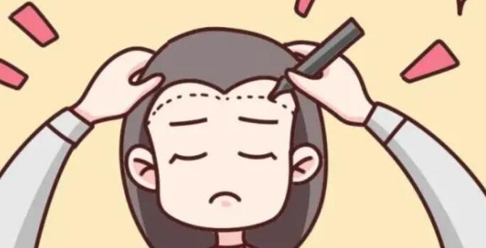 增加发际线的方法有哪些?推荐几种果不错的方法!