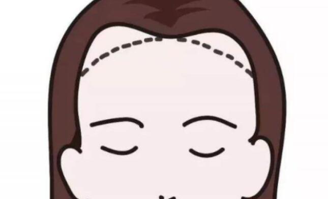 增加发际线的方法有哪些?推荐几种果不错的方法!