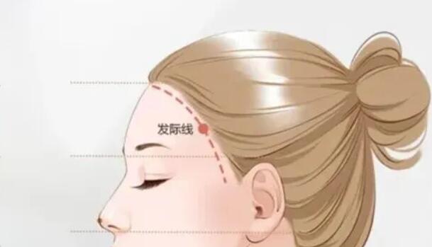 增加发际线的方法有哪些?推荐几种果不错的方法!