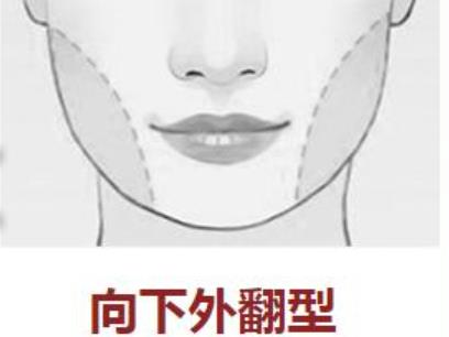 下颌骨整形价钱贵吗?做下颌角整形手术需要注意哪些事情?