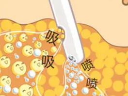 福州海峡整形怎么样？章至甫、张光泽等医师技术不错！有案例参考
