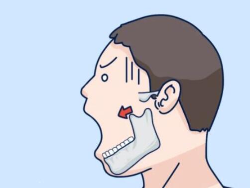 徐学东医生怎么样？医生实力点评及真人瘦脸果图！