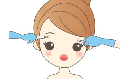纹眉后结痂结痂过程图曝光！美女做完纹眉的反馈分享！