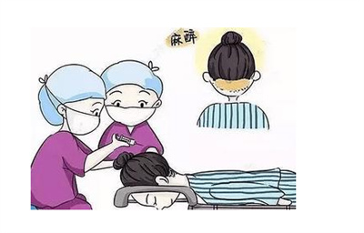 植发的危害有哪些？手术有风险吗？3分钟了解后再做决定！