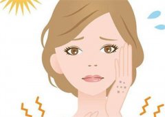 夏天晒黑了怎么办？除了补水需注意哪些呢？