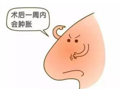 膨体材料隆鼻多少钱?影响价格因素4点阐述