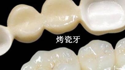 老年人换牙齿需要多少钱?具体价格受哪些影响?
