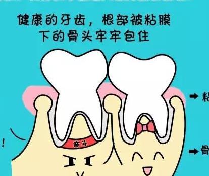 老年人换牙齿需要多少钱?具体价格受哪些影响?