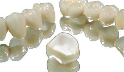 上海钴铬烤瓷牙价格多少钱?认清牙齿情况