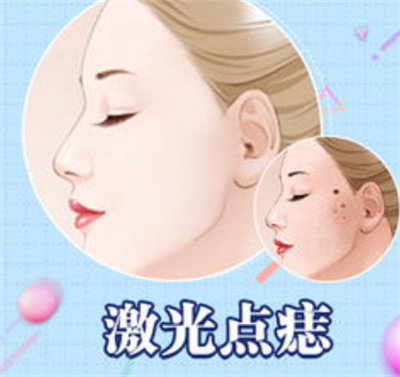 激光点痣多少钱?价格受哪些因素影响?