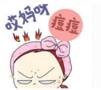 为什么额头长痘？4点原因带来介绍！