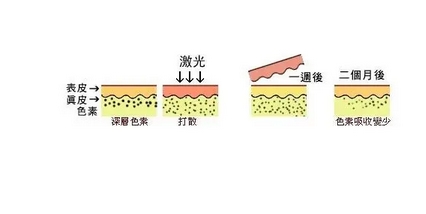 北京朝阳医院激光美容怎么样？去烫伤真实案例来袭！医生详细介绍~
