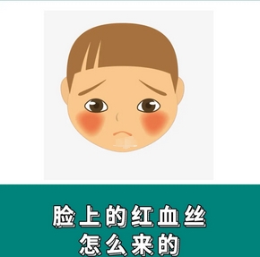 脸上红血丝怎么治？这几个技巧用处很大！日常修复，无瑕肌肤不是梦！