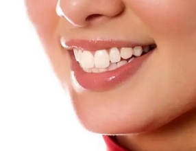 冷光美白牙齿好不好?牙齿美白方法哪种好?冷光美白原来还有这么多危害!