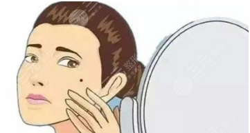 激光去痣大概多少钱？去的干净吗？激光的选择也很重要，快来看看！