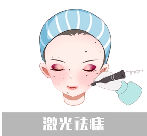 激光去痣大概多少钱？去的干净吗？激光的选择也很重要，快来看看！