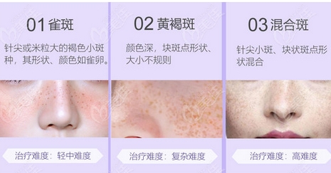北京协和医院激光收费是多少？传统优势项目有多热门！附医生详细介绍~
