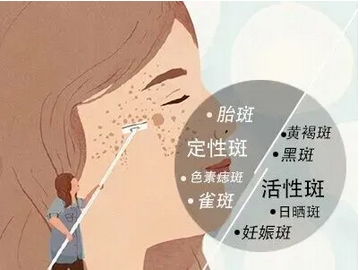 北京大学第一医院祛斑医生推荐！祛斑技术实力如何？带你进行深入探讨！