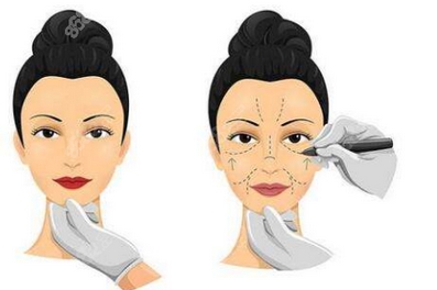 北京协和医院拉皮医生怎么样!医生排名|优秀口碑专家!医疗团队实力如何呢?