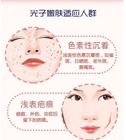 北京协和医院光子嫩肤多少钱一次?传统优势项目?让你告别斑点困扰~