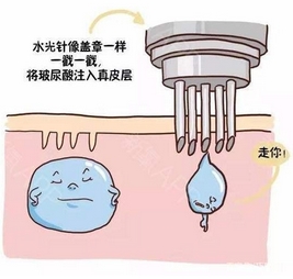 如何快速美白肌肤?四种超火美白方法分享!还需要注意哪些呢?