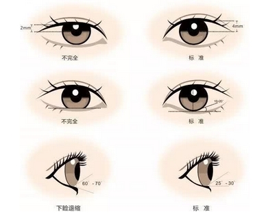 北京航空总医院做双眼皮怎么样?医院资料详细介绍!人气医美实力推荐!