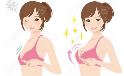 傲若拉假体价格多少钱?丰胸贵不贵?注意事项又有哪些呢?