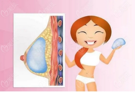 傲若拉假体价格多少钱?丰胸贵不贵?注意事项又有哪些呢?