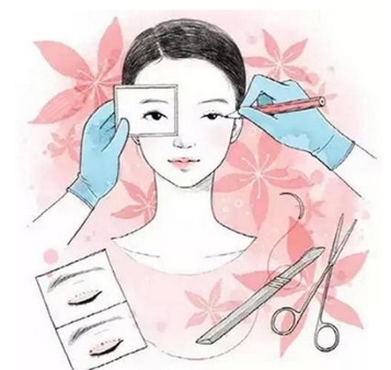 北大医院双眼皮手术多少钱?多久可以恢复自然呢?医生技术优势分享!