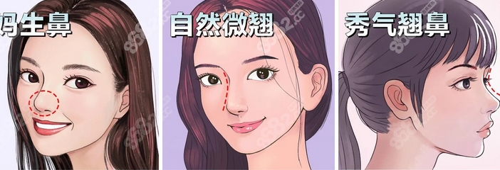 北京协和医院做鼻子哪个厉害?鼻综合医生如何选择?医生攻略已整理,快来看一下吧!