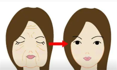 电波拉皮的价钱是多少?电波拉皮效果怎么样?必读!