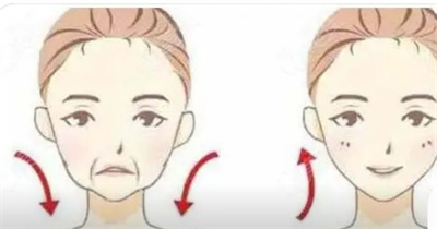 电波拉皮手术价钱受哪些因素影响？术后如何护理呢？