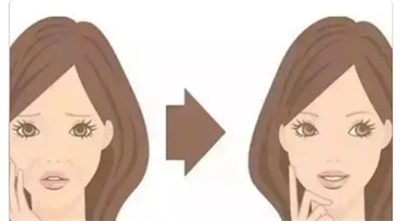 拉皮手术副作用有哪些?拉皮皮手术后应该如何护理?
