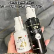 蔓迪米诺地尔酊生发液有副作用吗？哪些人群不能用？
