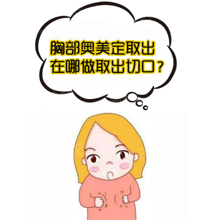 奥美定取出价格是多少?受哪些因素影响?注意事项?