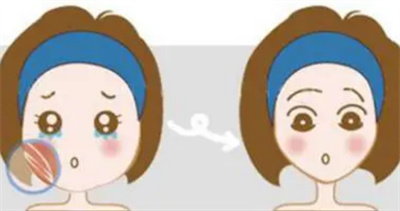 瘦脸果可以瘦咬肌吗？瘦脸果对人体有什么影响吗？