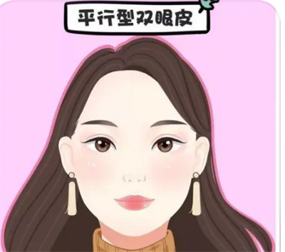埋线双眼皮需要多少钱?埋线双眼皮手术时要注意哪些事项?