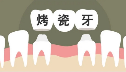 北京烤瓷牙价格表公开!烤瓷牙齿如何选择医院呢?牙齿修复后需要注意哪些?